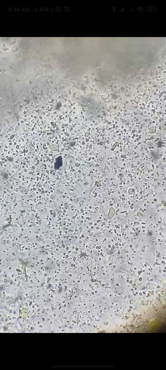 Captura microscópica aportada para contextualizar la observación coproparasitaria referida, sin identificación taxonómica documentada